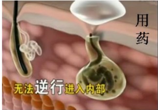 用药2.jpg
