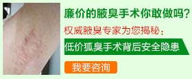 低价手术背后的安全隐患.jpg