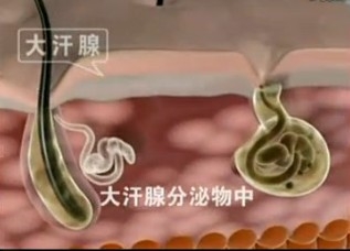 腋臭发病原理.gif