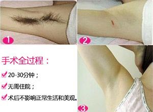 电脑手术过程.jpg